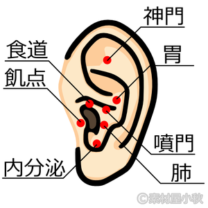 耳ツボに針を刺すの？　痛くない？